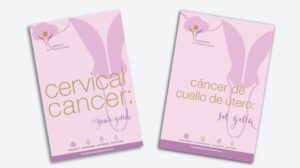 January is Cervical Health Awareness Month. In addition to cervical cancer patient resources that are available on the Foundation for Women’s Cancer (FWC) website, there is a recently updated cervical cancer brochure (Cervical Cancer: Your Guide) and a new Spanish language version (Cáncer de Cúello de Útero: Su Guía). These titles can be downloaded from the website and are also available for professional printing and shipping. To order brochures, simply complete the FWC brochure order form and return it by email, fax or mail along with payment. If you have any questions about ordering, please contact FWC at 312-578-1439 or FWCinfo@sgo.org. Risk factors for cervical cancer FWC encourages everyone to learn about the risk factors associated with cervical cancer. Almost all cervical cancer is caused by a persistent human papillomavirus (HPV) infection Cervical cancer usually affects women between 30 and 50, but younger women are also at risk Smoking weakens the immune system, which can lead to persistent HPV infection